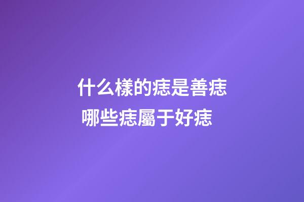 什么樣的痣是善痣 哪些痣屬于好痣
